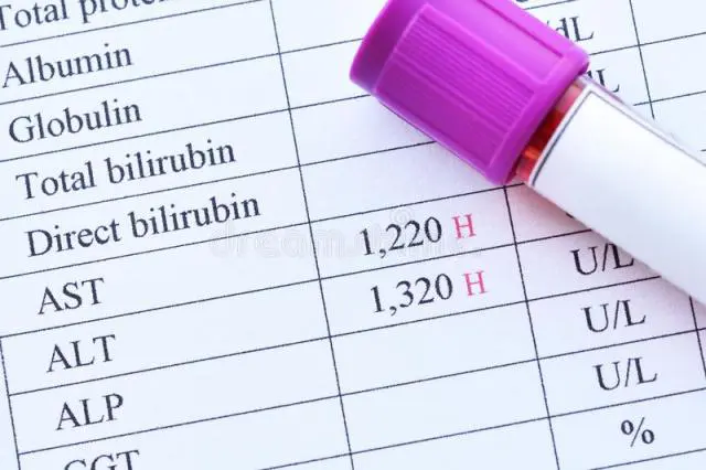 alkalin-fosfataz-testi-fiyatlari