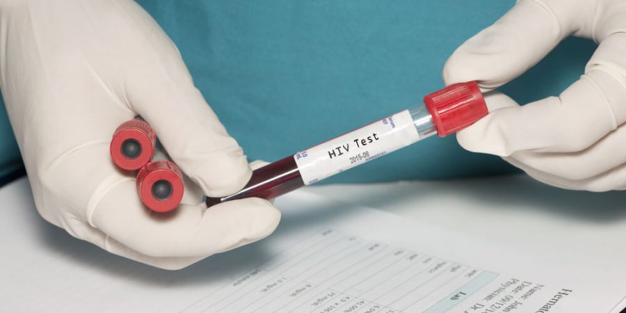 anti-hiv-testi-900×450