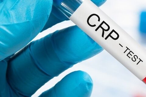 crp-nedir-crp-neden-yukselir-480×320