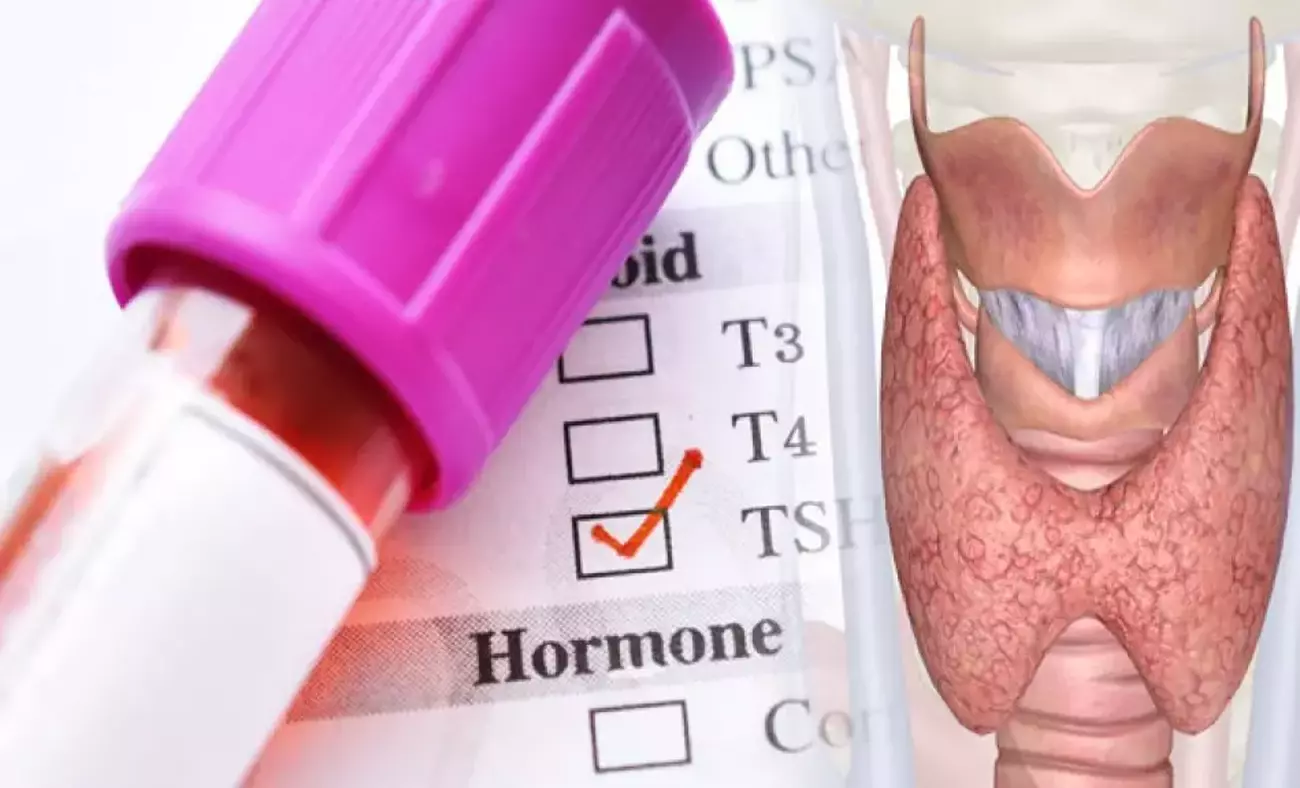 tsh_testi_nedir_tsh_belirtileri_nelerdir_tsh_hormon_degeri_kac_olmali_1611741886_8959